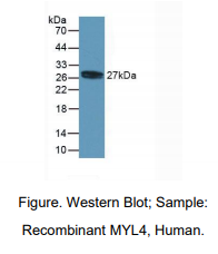 人肌球蛋白轻链4(MYL4)多克隆抗体