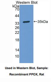 大鼠原卟啉原氧化酶(PPOX)多克隆抗体