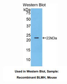 https://msimg.bioon.com/bionline/goods-no-pic.png