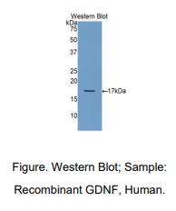 https://msimg.bioon.com/bionline/goods-no-pic.png