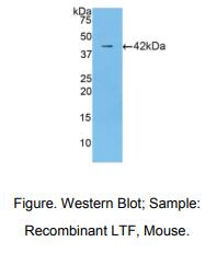 https://msimg.bioon.com/bionline/goods-no-pic.png