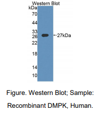 人肌强直性营养不良蛋白激酶(DMPK)多克隆抗体