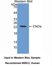 人含杆状病毒IAP重复蛋白2(BIRC2)多克隆抗体