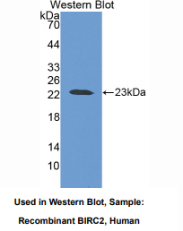 https://msimg.bioon.com/bionline/goods-no-pic.png