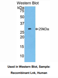 https://msimg.bioon.com/bionline/goods-no-pic.png