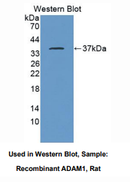 https://msimg.bioon.com/bionline/goods-no-pic.png