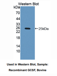 https://msimg.bioon.com/bionline/goods-no-pic.png