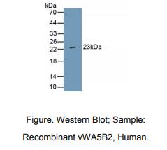 人含血管性血友病因子A域结合蛋白5B2(vWA5B2)多克隆抗体