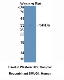 https://msimg.bioon.com/bionline/goods-no-pic.png