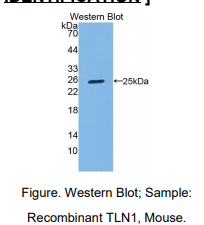 https://msimg.bioon.com/bionline/goods-no-pic.png