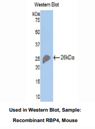 小鼠视黄醇结合蛋白4(RBP4)多克隆抗体