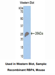 https://msimg.bioon.com/bionline/goods-no-pic.png