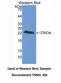 https://msimg.bioon.com/bionline/goods-no-pic.png