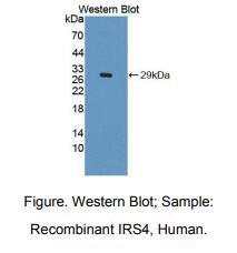 https://msimg.bioon.com/bionline/goods-no-pic.png