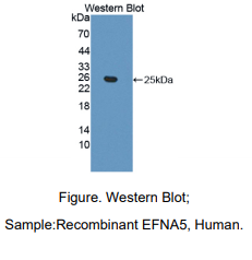 人肝配蛋白A5(EFNA5)多克隆抗体