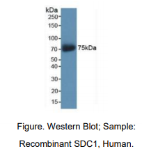 https://msimg.bioon.com/bionline/goods-no-pic.png