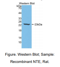 https://msimg.bioon.com/bionline/goods-no-pic.png