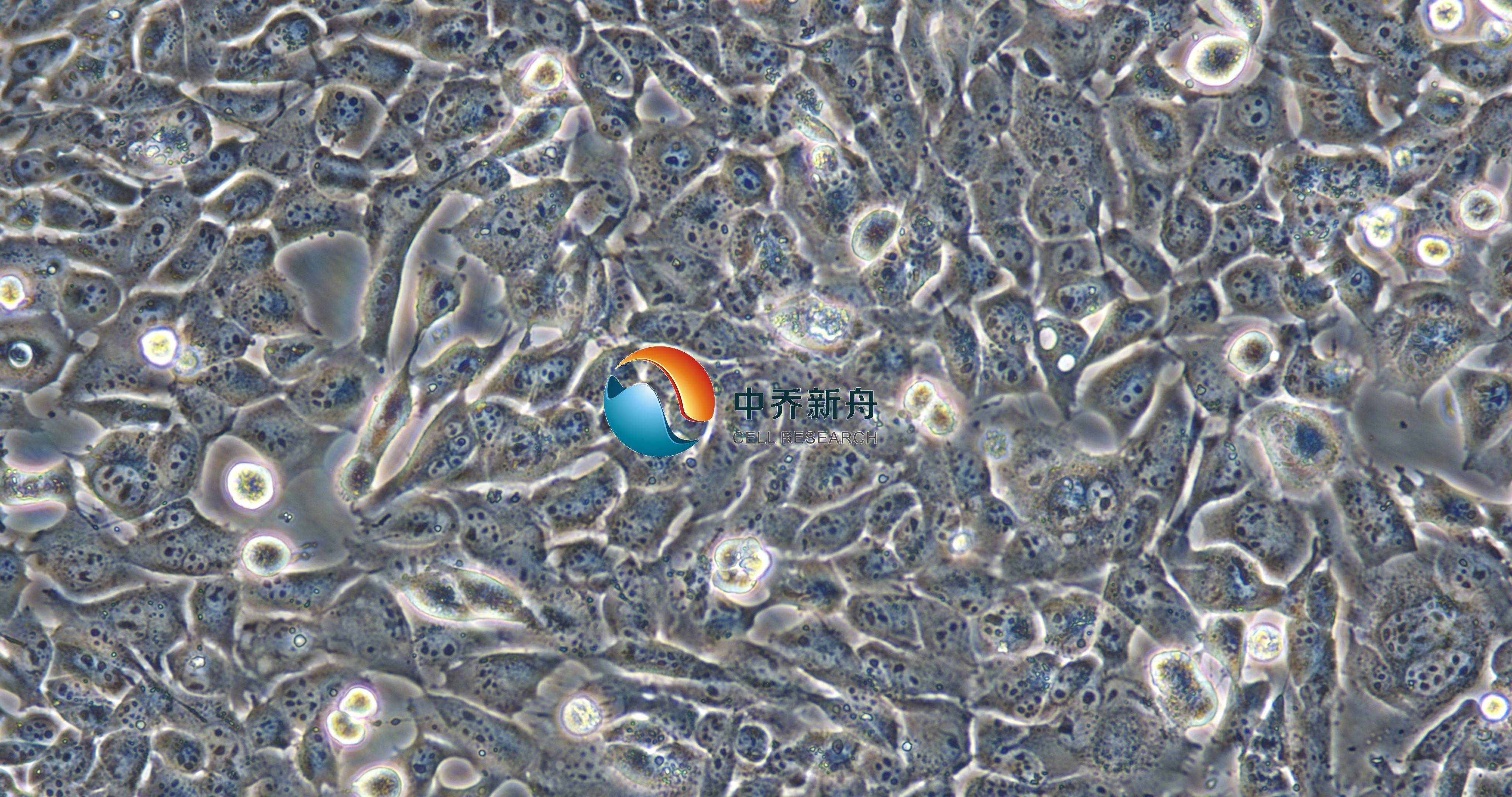 glioma261-GFP+LUC小鼠神经胶质瘤细胞-绿色+荧光素酶标记