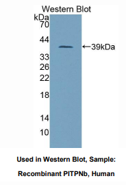 人磷脂酰肌醇转运蛋白β(PITPNb)多克隆抗体
