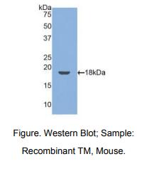 https://msimg.bioon.com/bionline/goods-no-pic.png