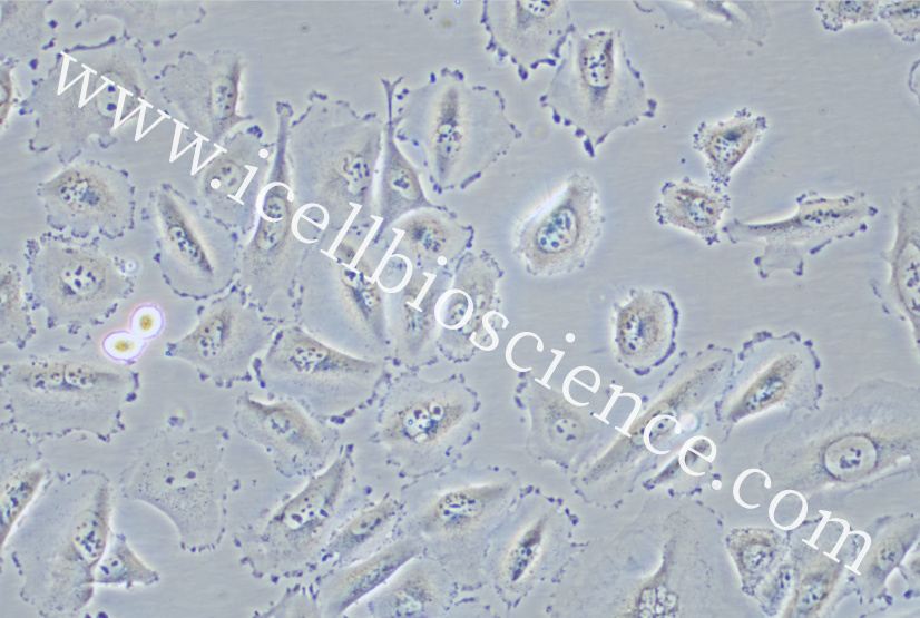 HCC-44细胞/HCC44细胞/HCC-44/HCC44/人非小细胞肺癌细胞