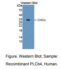 人磷酯酶Cβ4(PLCb4)多克隆抗体