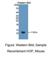 https://msimg.bioon.com/bionline/goods-no-pic.png