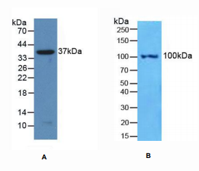 人核因子κB2(NFkB2)多克隆抗体