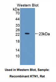 大鼠驱动结合蛋白1(KTN1)多克隆抗体