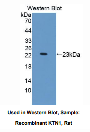 https://msimg.bioon.com/bionline/goods-no-pic.png