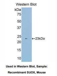 小鼠亚硫酸盐氧化酶(SUOX)多克隆抗体
