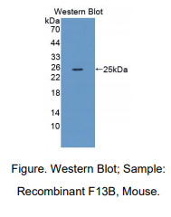 小鼠凝血因子ⅩⅢB肽(F13B)多克隆抗体