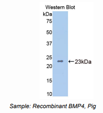 https://msimg.bioon.com/bionline/goods-no-pic.png