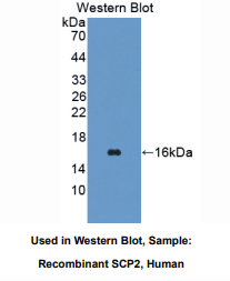 https://msimg.bioon.com/bionline/goods-no-pic.png