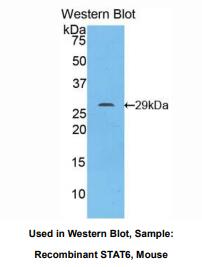 小鼠信号传导转录激活因子6(STAT6)多克隆抗体