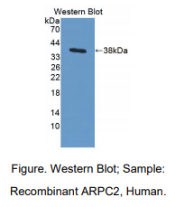 https://msimg.bioon.com/bionline/goods-no-pic.png