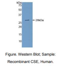 https://msimg.bioon.com/bionline/goods-no-pic.png