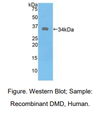 人肌营养不良蛋白(DMD)多克隆抗体