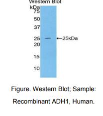人乙醇脱氢酶1(ADH1)多克隆抗体