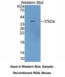 https://msimg.bioon.com/bionline/goods-no-pic.png