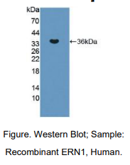 https://msimg.bioon.com/bionline/goods-no-pic.png