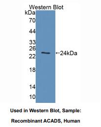 https://msimg.bioon.com/bionline/goods-no-pic.png