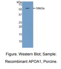 https://msimg.bioon.com/bionline/goods-no-pic.png