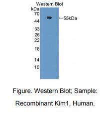 人肾损伤分子1(Kim1)多克隆抗体