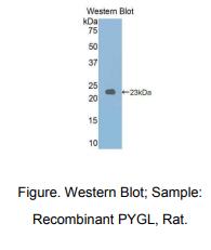 https://msimg.bioon.com/bionline/goods-no-pic.png