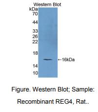 大鼠再生胰岛衍生蛋白4(REG4)多克隆抗体