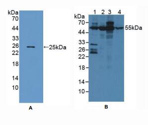 人失调蛋白10(ATXN10)多克隆抗体