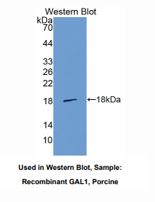 https://msimg.bioon.com/bionline/goods-no-pic.png