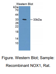 https://msimg.bioon.com/bionline/goods-no-pic.png