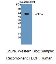 人亚铁螯合酶(FECH)多克隆抗体